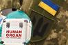 В Украине запретили трансплантацию органов погибших военных
